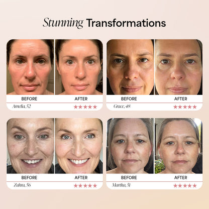 Dermave™ Deep Collagen Mask