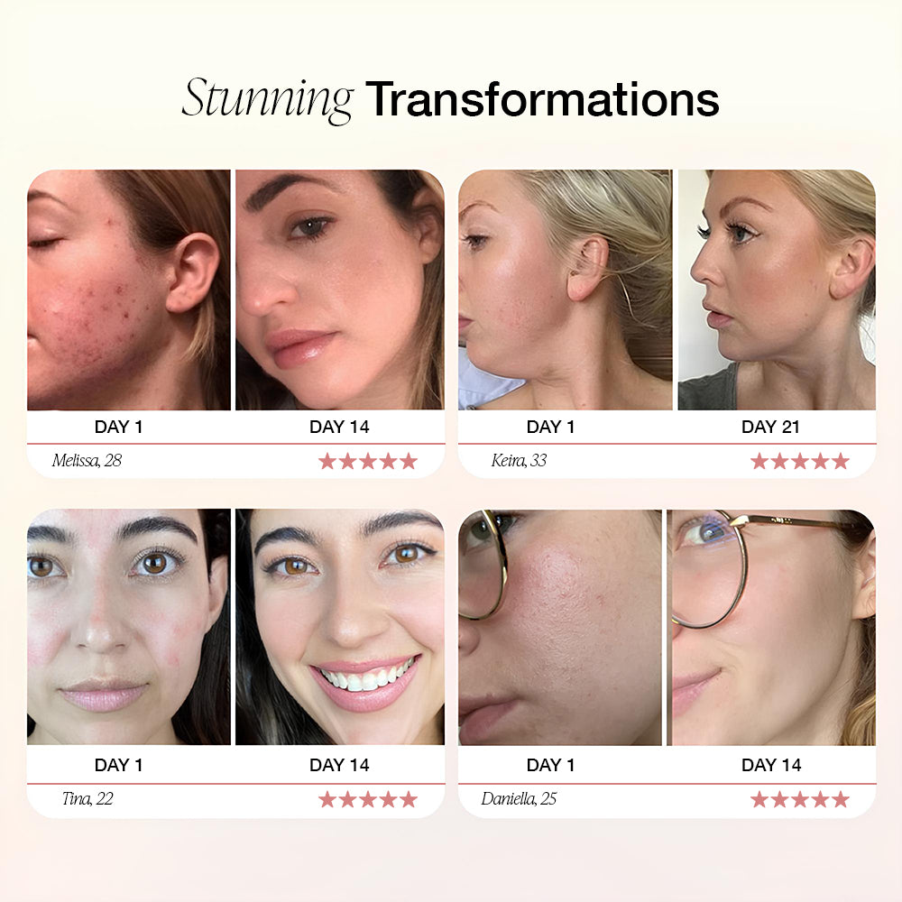 Dermave™